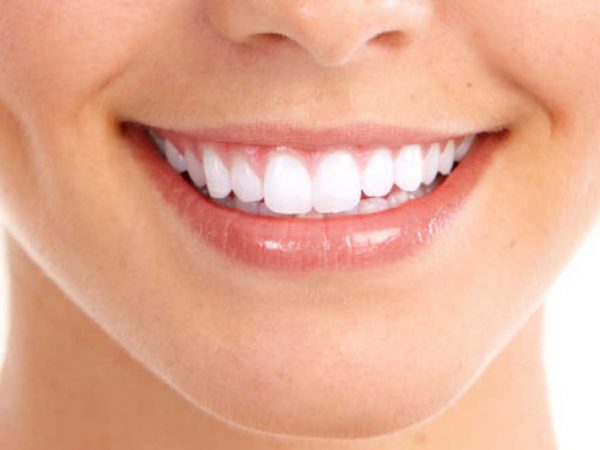 Dental veneers – the mistakes to avoid
