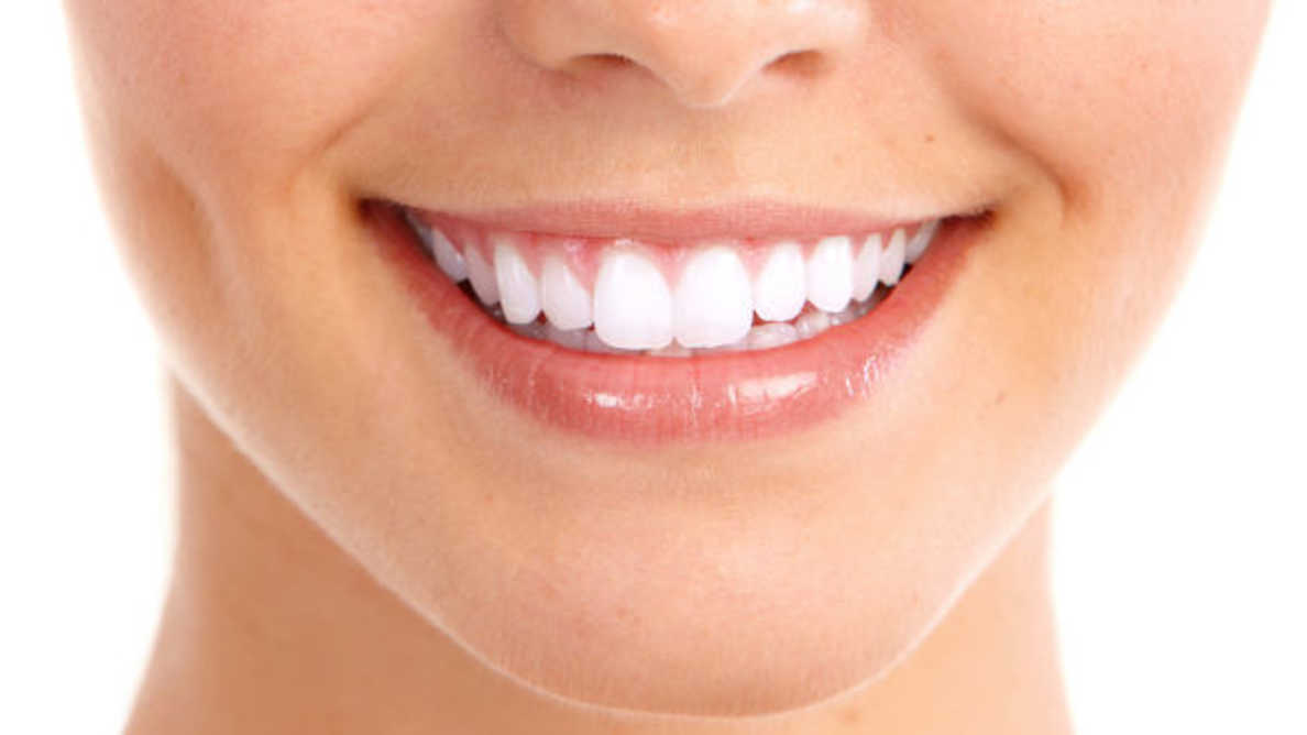 Dental veneers – the mistakes to avoid